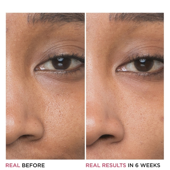 It Bye Bye Pores - Picture 5 of 8